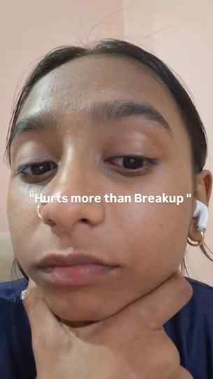 Clear skin ppl can never understand 💔💔💔
.
.
.
.
.
.
.
.
.
