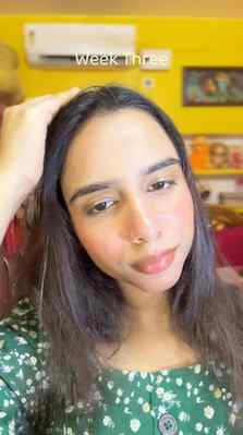From struggling with hair fall to staying consistent for 4 w