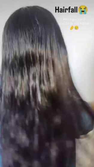 Comment me btaye please 😭
.
.
.
.
.
#hairfall #brandstrate