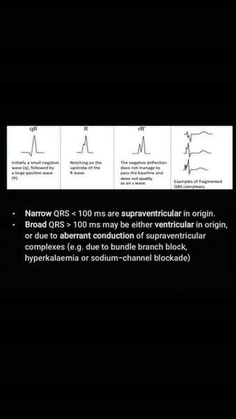 qRs Continued P13
#easymed #doctor #medicine #medicaleducati