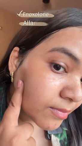 Must have product for acne prone skin #LetsTalkAcne #Bioderm