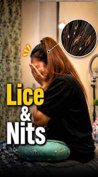 I was suffering from lice and stubborn nits, along with nons