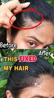 🚨 STOP adjusting your hairstyle to hide hair gaps..!!

I di