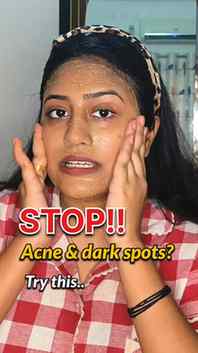 നിങ്ങൾക്കും ഇത്പോലെ clear skin വേണോ?!
COMMENT for link🔥

#f