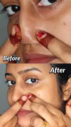 ഒരൊറ്റ use il ഇത്രെമാത്രം RESULT🔥facial വേണ്ടാ ഇത് മതി🤐
.
