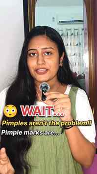Still dealing with post-acne marks? 👀
I've been using the E
