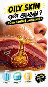 முகம் எப்போதும் எண்ணெய் போல இருக்கா? 😳 Oily skin-க்கு காரணம
