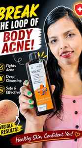 AD I thought my body acne was hormonal. Turns out it was ger