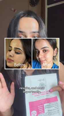 try this sheet mask from @indulgeo.essentials ✨
.
.
.
.
.
#s
