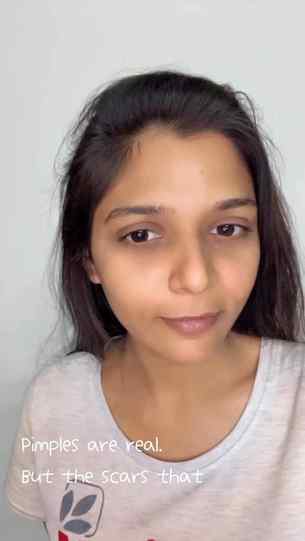 ‘Himalaya Purifying Neem Serum
Best of Nature + Science
2% N