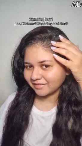 Notice your hair isn’t as full as before?
Hair thinning, low