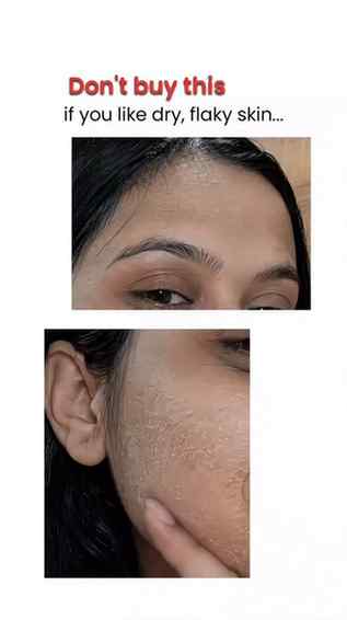 Dry skin needs hydration without that heavy, sticky feeling—