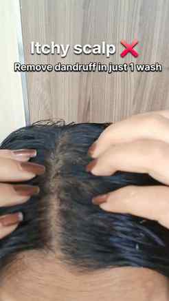 ✨ Dandruff gone in just ONE wash?! 😳🫧

If your scalp is fe