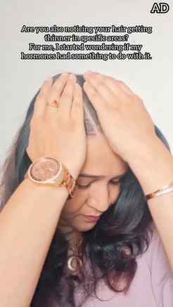 Hairfall had become a constant concern for me, especially se