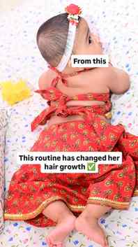 Ever since she was born, my daughter has had quite fine, thi