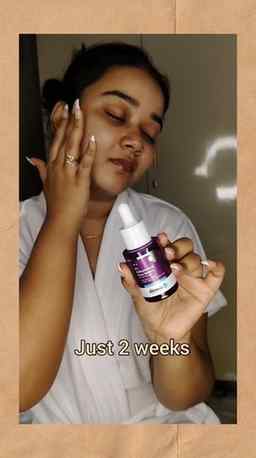 #ad This 300rs serum saved my skin in Kolkata humidity 😭 @t
