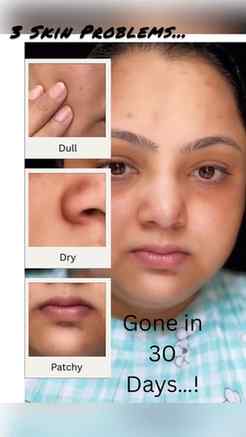 Such an effective moisturiser by Pilgrim India!
Comment your