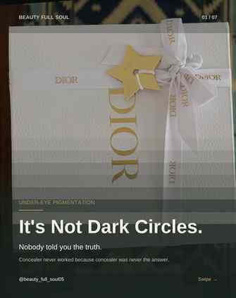 It’s not dark circles. You were just misdiagnosed.
Shadows