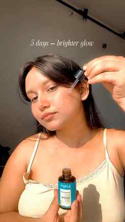 Agar aapko Dark Spots, acne marks, uneven skin tone aur larg