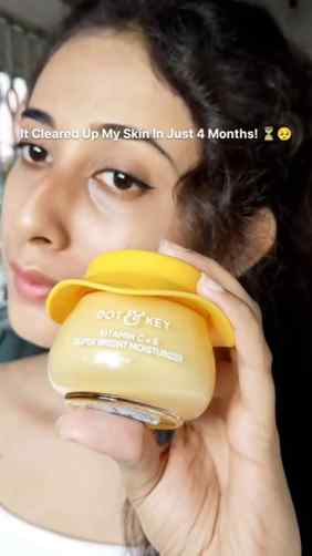 My skin before using this vs. after 4 months of using it con