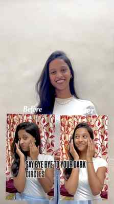 Comment for link ! 🔗 

#skincare #transformation #nidhiskin