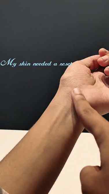 POV: your skin just needed a little reset π©΅β¨
No complicate