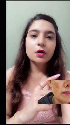 @thedermacoindia 
Are you struggling with dark spots and pig