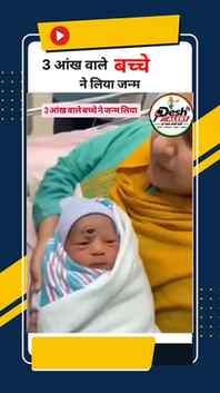 3 आंख वाले बच्चे निया जन्म