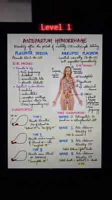 Are there levels to note taking?
As an avid note taker - I’d