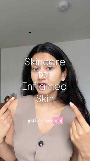 Using Drugstore pharmacy skincare to fix my irritated/inflam