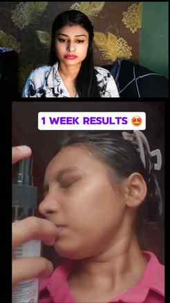 "7 din mein glass skin?! ๐ฑ Comment 'GLOW' link ke liye! ๐"