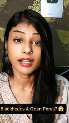 "Yeh galti mat karna! 😱 (Blackheads permanent hatane ki tri