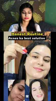 Acne free skin 
@amazon 
@amazondotin