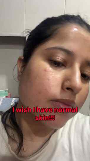 Stop setting unnecessary standards for your skin🩵.