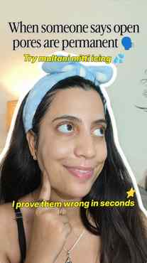 Follow for more such amazing tips || Best Remedy for Open po