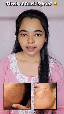 Dark spot niye ar tension noy! ✨
Charwee Dark Spot Remover t