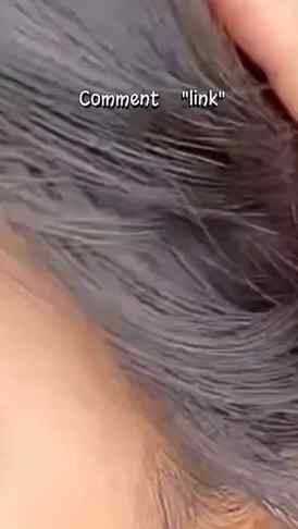 Goodbye itchy, flaky scalp! 👋
Comment link 🔗 ✨