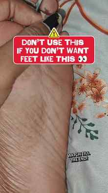 Don’t use this foot peeling mask unless you want insanely so