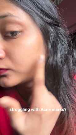 Comment for link..🍒

Your skin deserves real results, not j