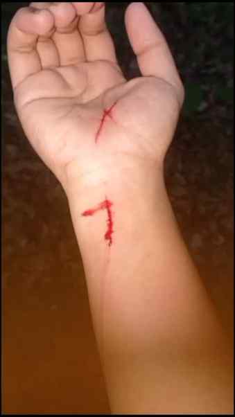 Cat lovers related🐱🙂
#cat #catbite #catscrstch #viral
