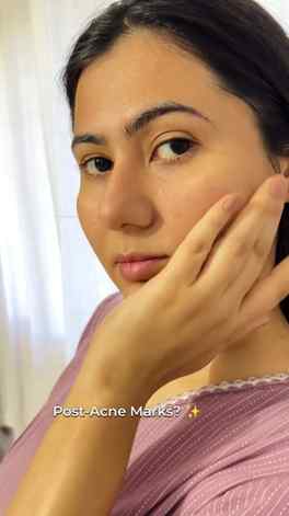 Dull skin and post-acne marks? Lately, I’ve been reaching fo