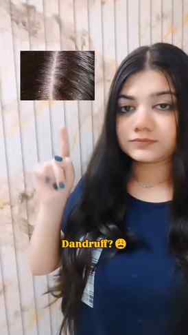 Dandruff & itchy scalp? 
Let’s take care of it! 🫧💙
The Der