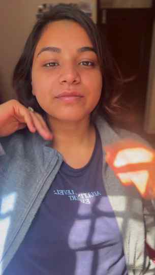 No concealer, no foundation and my skin has never looked bet