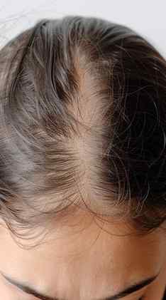 Stay away from this product! Otherwise your hair will grow f