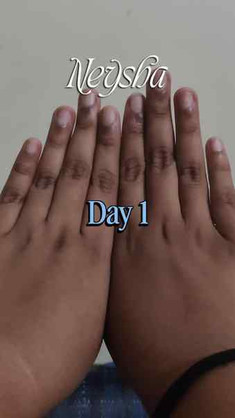Within a week result 😱 

#neysha #skincare #influencer #con
