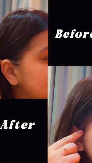 “Grey hair? 3 seconds… vanish! India ka pehla Korean natural