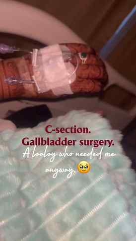 Two surgeries. One baby who still needed his mama. 🤍
Heali