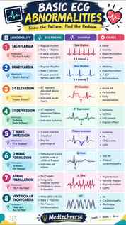 🫀 Basic ECG Abnormalities — Save This! 📚
Master these 8 i
