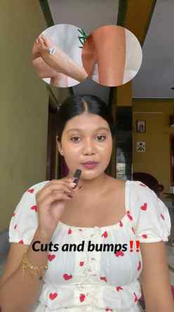 Unwanted hair remove করার জন্য এখন আর waxing বা shaving-এর ঝ