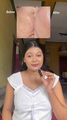 Comment down for the link 🔗
@myskinq
#skinq #myskinq
